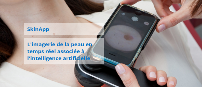 SkinApp par Anapix