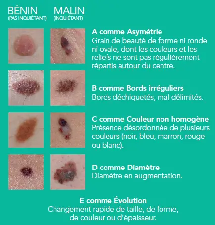 cancers de la peau