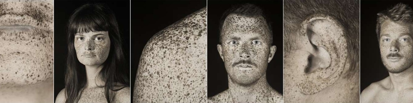 Portraits multiples avec dommages des UV sur la peau