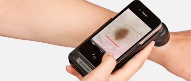 L'iPhone transformé en dermatoscope numérique
