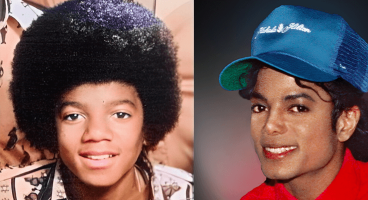 évolution de la couleur de peau de Mickel jackson